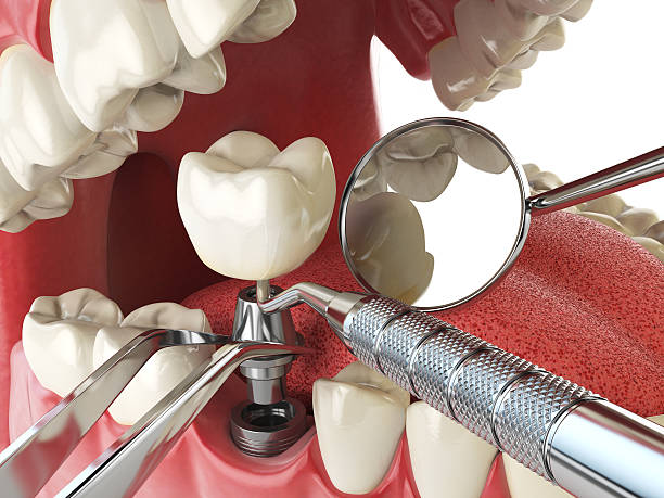 Best Emergency Treatment for Toothache in Forest Hill, TX