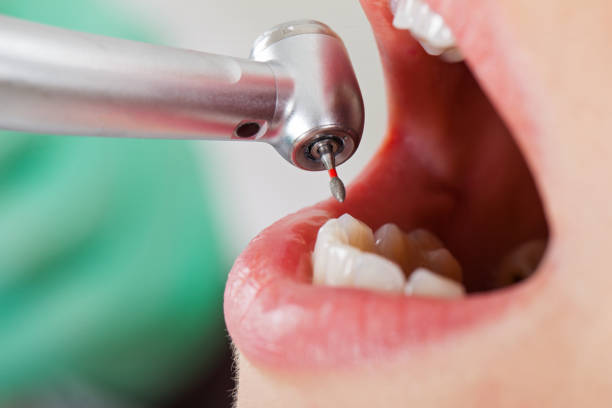 Best Emergency Dental Care for Trauma or Injury in Forest Hill, TX